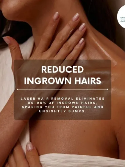One of the biggest benefits of laser hair removal is the elimination of 80-90% of ingrown hairs. This treatment spares you from the painful and unsightly bumps that often come with shaving and waxing.