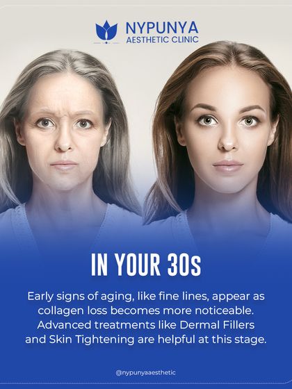 In your 30s, early signs of aging like fine lines appear as collagen loss becomes more noticeable. This is when advanced treatments like dermal fillers and skin tightening become particularly helpful to support your skin's structure.