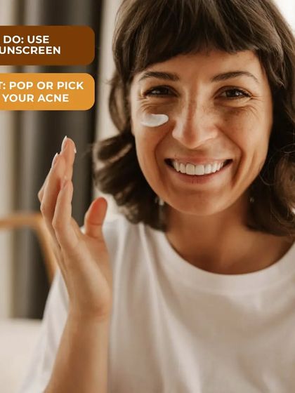 Two fundamental rules for acne care: always use sunscreen to protect your skin and prevent marks from darkening, and never pop or pick at your acne to avoid scarring.