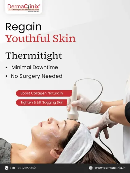 This image shows the ThermiTight procedure, a non-surgical treatment to tighten and lift sagging skin. It works by using radiofrequency energy to boost collagen production naturally with minimal downtime.