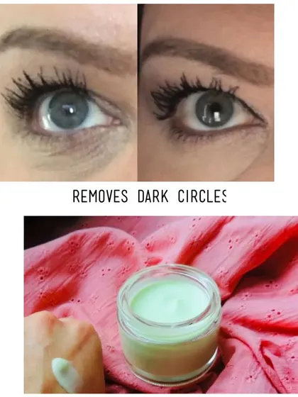 Dark circles can be tough, but my Magical Under Eye Cream is here to help. This before and after shows how it works to reduce puffiness and brighten the under-eye area.