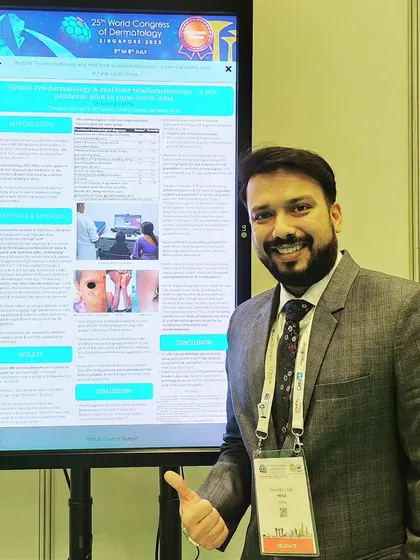 At the 2023 World Congress of Dermatology in Singapore, our poster presentation on providing specialist dermatology services in rural India was upgraded to "Featured Poster" status. I am proud of this recognition for our work.