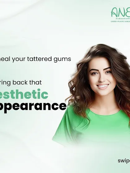 A healthy smile starts with healthy gums. This image represents my advanced laser gum treatments, which are designed to heal gums and restore their aesthetic appearance without the pain, bleeding, or stitches of traditional surgery.