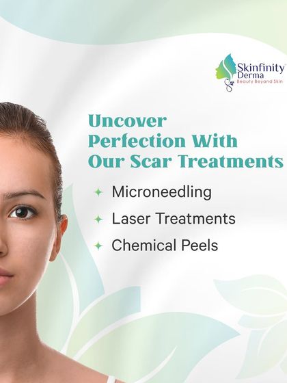 Uncover perfection with our scar treatments. We offer a combination of microneedling, laser treatments, and chemical peels to minimize the appearance of acne scars and reveal smoother skin.