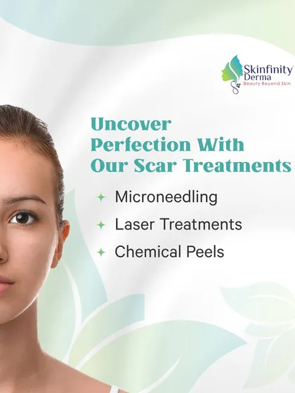 Uncover perfection with our scar treatments. We offer a multi-pronged approach with Microneedling, Laser Treatments, and Chemical Peels to effectively reduce scarring and reveal smoother, clearer skin.