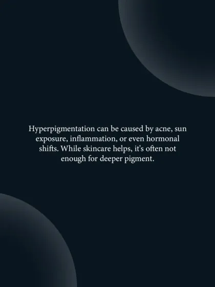 This graphic explains that hyperpigmentation can be caused by acne, sun exposure, inflammation, or hormonal shifts, and why topical skincare alone is often not enough for deep pigment.