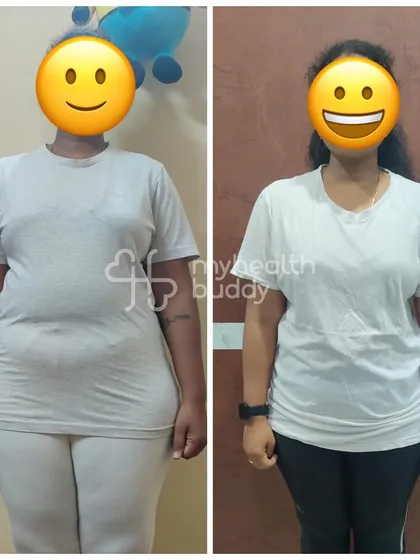 A front view of Ramya's 6 kg weight loss journey. She successfully navigated post-pregnancy fitness challenges with a simple, sustainable plan.