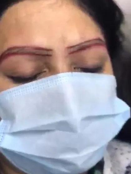 This is a crucial step in the eyebrow microblading process. Before the procedure, we carefully map and outline the desired shape to ensure the final result is symmetrical and perfectly suited to your facial features.