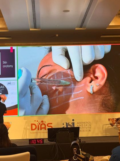 A slide from a live demonstration at the DIAS conference, showing the detailed anatomical mapping required for safe and effective filler injections. Precision is key in aesthetic medicine.