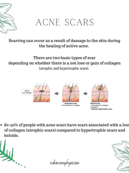 After active acne heals, it can leave behind scars. These are broadly categorized as atrophic (loss of collagen) or hypertrophic (gain of collagen).