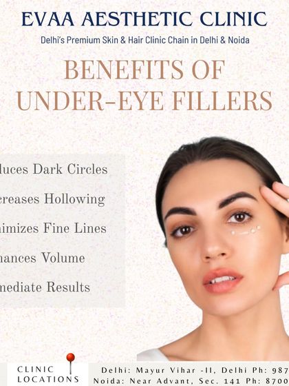 This graphic details the benefits of under-eye fillers. This treatment offers immediate results by reducing dark circles, decreasing hollowing, minimizing fine lines, and enhancing volume for a refreshed look.