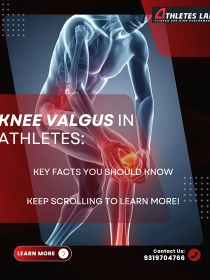 Knee valgus, or the inward collapse of the knee, is a significant risk factor for injury in athletes. This educational series breaks down the key facts every athlete should know about this common movement fault.