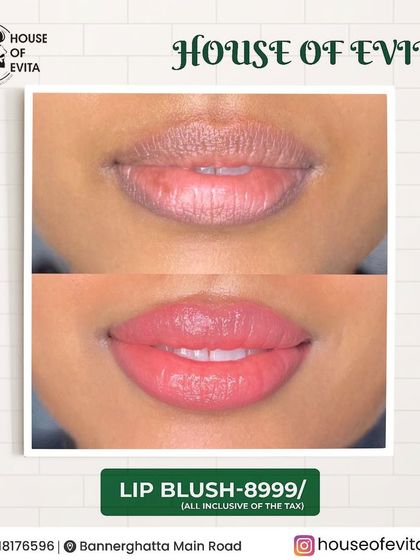 This is a beautiful Lip Blush result. The client wanted a soft, natural pink tint. The final look is a subtle wash of color that makes her lips look fuller and more vibrant.
