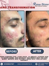 Advanced Skin Treatments