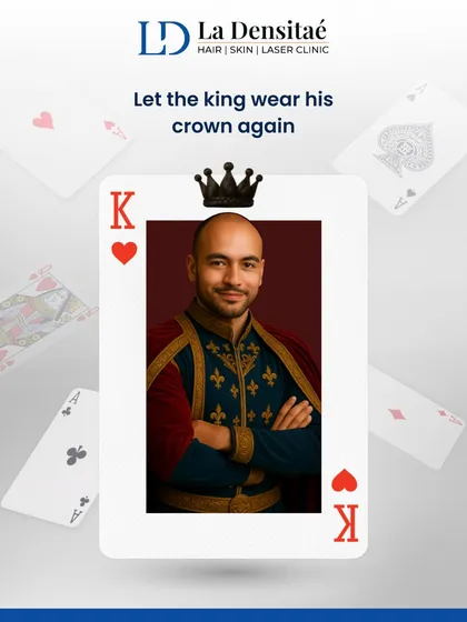 A true king never settles for less than the best. This post emphasizes that your crown deserves royal treatment, and my clinic offers world-class hair restoration solutions to bring back your authority, presence, and confidence.