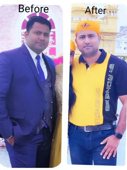This is a powerful transformation that goes beyond just weight loss. In four months, my client lost 10 kgs, and more importantly, his medical reports showed a reversal of fatty liver and normalized sugar and cholesterol levels, all without medication. This was achieved by changing food habits and incorporating simple physical exercise.