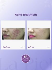 Medical Dermatology for Skin, Hair & Nail Conditions