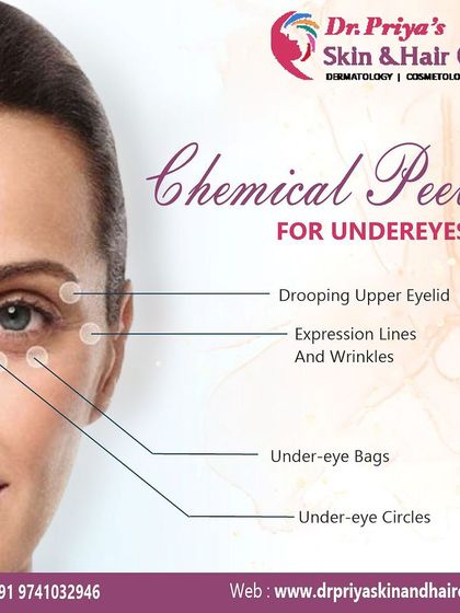 Priya J Talageri - Anti-Aging & Skin Tightening Chemical Peels & Advanced Facials photo 8