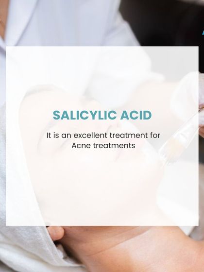 Salicylic acid, a Beta Hydroxy Acid, is an excellent ingredient for treating acne. It is oil-soluble, allowing it to penetrate deep into the pores to dissolve the debris and sebum that cause blackheads and pimples. I often use it in my clinical peels for oily and acne-prone skin.