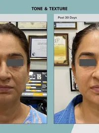 Anti-Aging & Skin Rejuvenation
