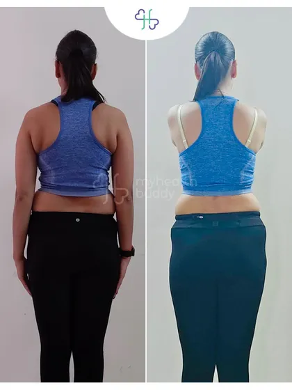 A 3 kg weight loss over 6 months, but a huge gain in strength and confidence. This client learned to push beyond her limits safely, celebrating every small victory along the way.