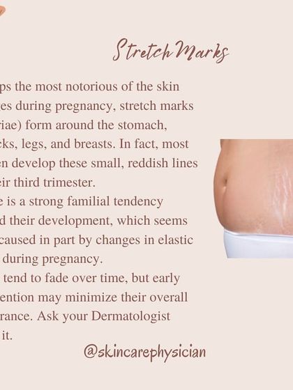 Most women develop stretch marks by their third trimester, especially around the stomach, buttocks, and breasts. I can discuss effective post-delivery treatments like microneedling to help minimize their appearance.