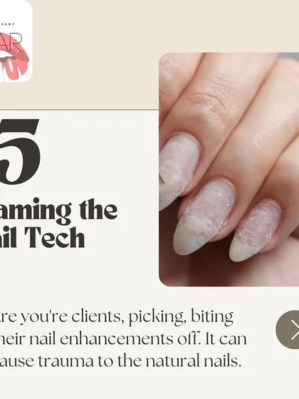 Blaming the nail tech isn't always the answer. Picking or biting at your nail enhancements can cause significant trauma to your natural nails, leading to damage.