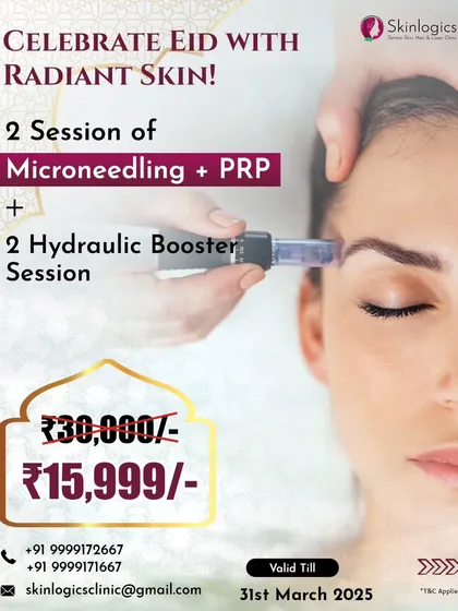 Get radiant skin with this special Eid offer. It combines 2 sessions of Microneedling with PRP and 2 Hydraulic Booster sessions for deep rejuvenation at a significantly discounted price.