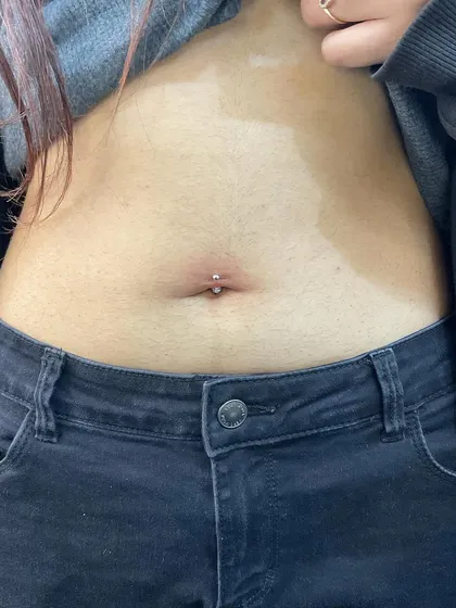 A freshly done navel piercing, showing minimal redness. Proper technique and aftercare are key to a smooth healing journey.