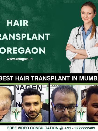 We provide services across Mumbai, including Goregaon. This graphic shows examples of successful local cases, reinforcing that you don't have to travel far for the best hair transplant in Mumbai.