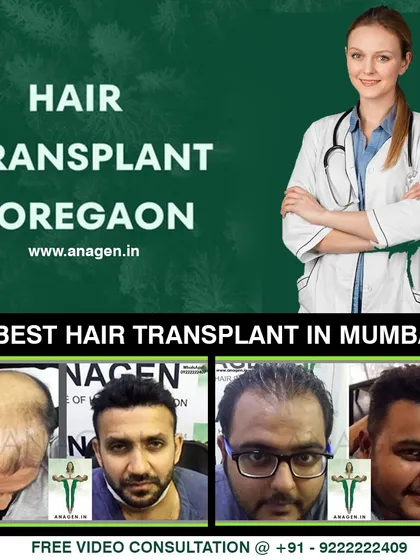 We offer the best hair transplant services in Goregaon, Mumbai. This promotional image showcases our excellent results and invites potential clients for a free video consultation.