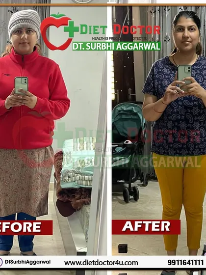 Meet Ms. Yashika, a new mother who began her postpartum journey with me just two months after delivery. She successfully lost 10 kgs in three months by following a diet plan designed to support both her and her baby's nutritional needs without any crash dieting.