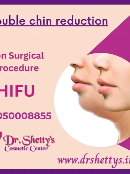 A double chin can be addressed without surgery. This shows the potential results of a non-surgical double chin reduction using High-Intensity Focused Ultrasound (HIFU), a procedure that tightens skin and reduces fat for a sharper jawline.