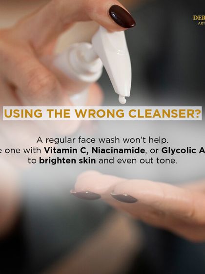 Using the wrong cleanser can worsen pigmentation. This graphic advises using a face wash with Vitamin C, Niacinamide, or Glycolic Acid to brighten skin.