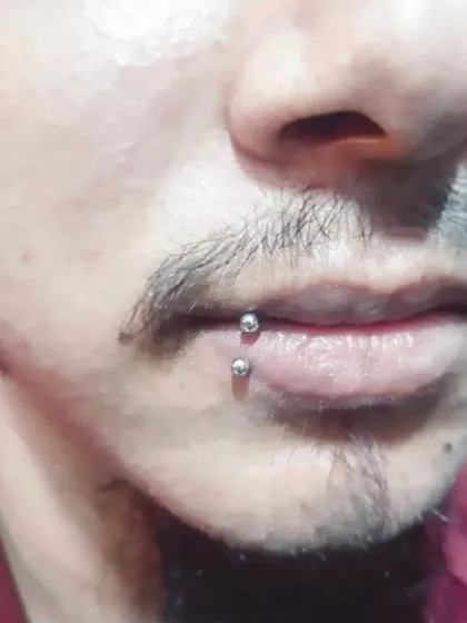 This is a vertical labret piercing, a popular choice for lip adornment. I focus on precise alignment to ensure the barbell sits perfectly straight on the lip.