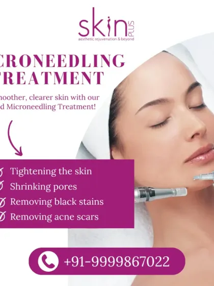 Collagen Boosting: Microneedling & PRP photo 9