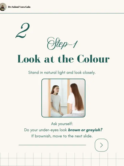 The first step is to look at the color of your under-eyes in natural light. Are they brownish or greyish? The color provides a clue to the underlying cause, guiding us toward the correct treatment path.