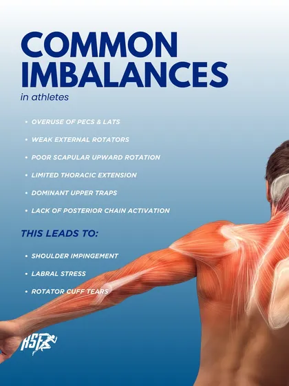 This image highlights common imbalances in athletes that lead to shoulder issues like impingement and rotator cuff tears. These include overuse of pecs and lats, weak external rotators, and poor scapular upward rotation.