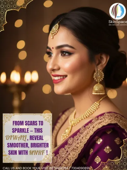 From scars to sparkle, unveil your festive best with Microneedling RF (MNRF). This treatment is perfect for reviving dull or scarred skin by reducing acne scars, improving texture, and enhancing collagen production for a smooth, radiant complexion.