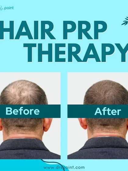 This before and after image shows the real results of our Hair PRP Therapy. We use the body's own healing properties to significantly reduce hair loss and promote new, healthy growth.