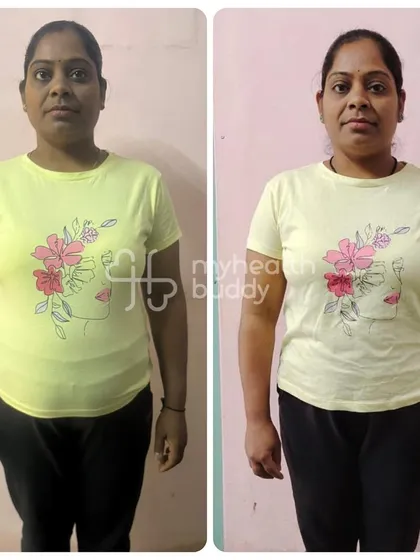 Rekha's front view comparison. She reached her goal by combining the right nutrition with exercise, something she learned was key during our time together.