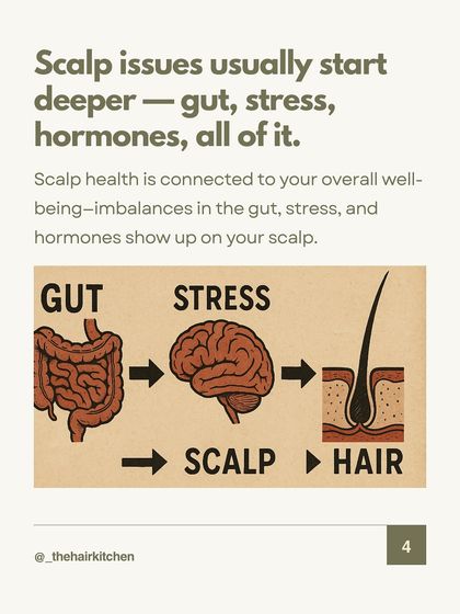 Scalp issues are rarely just skin deep. They are often symptoms of deeper imbalances related to your gut, stress levels, and hormones. This flow chart illustrates how your internal well-being directly manifests in the health of your hair.