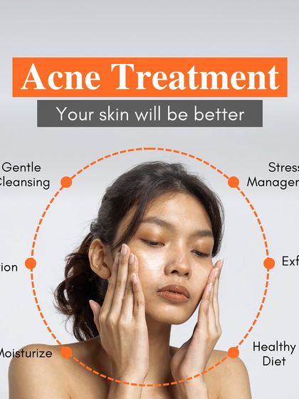 Struggling with acne? A successful treatment plan involves a holistic approach, including gentle cleansing, sun protection, a healthy diet, and professional exfoliation treatments to achieve clear skin.