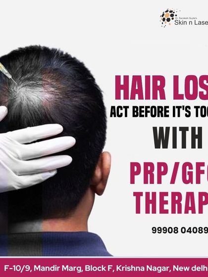 If you are experiencing hair loss, it is important to act before it's too late. PRP and GFC therapy are excellent first-line treatments to control hair fall and stimulate growth.