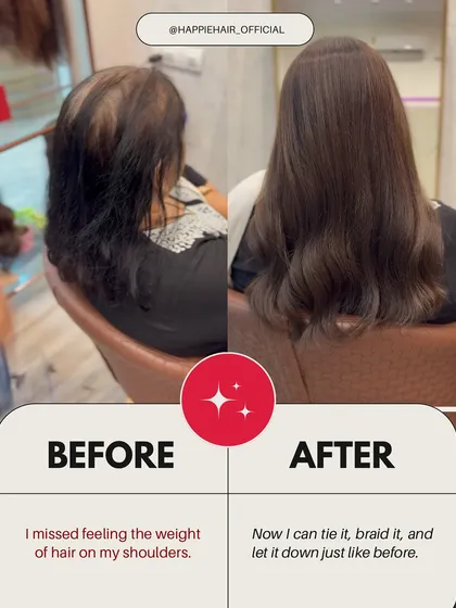 Many women miss the simple feeling of the weight of their hair on their shoulders. Our full-volume toppers and wigs bring back that familiar comfort, allowing you to tie, braid, or let your hair down.