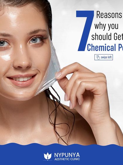 A chemical peel is a fantastic treatment for revealing new, radiant skin. Here are seven reasons why you should consider getting one.