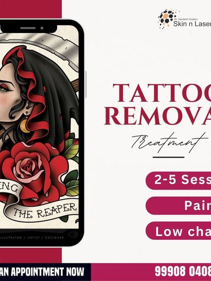 An advertisement for our tattoo removal treatment, highlighting that it is a painless procedure with low charges, typically requiring 2-5 sessions for significant fading or complete removal.
