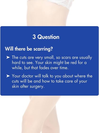 Scarring from liposuction is minimal. The incisions are very small, and we place them in discreet locations. Any redness typically fades over time with proper aftercare.