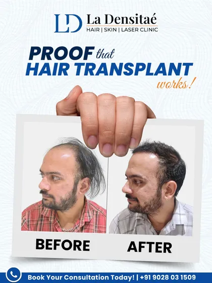 Unmesh Thatte was watching his hairline and confidence fade. He decided to take charge. This before-and-after shot shows the result of that decision, a natural look that reminds us real change starts with the first step.