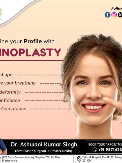 A successful rhinoplasty can redefine your profile and significantly boost self-confidence. This procedure can address concerns with nasal shape, improve breathing, and correct deformities.